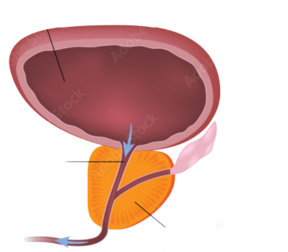 Prostate – Prosteman
